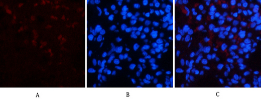 CD23 (3D1) Mouse mAb ABZ4059