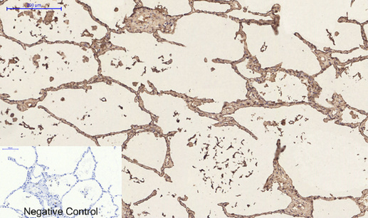 CD23 (3D1) Mouse mAb ABZ4059
