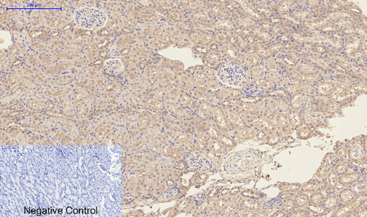 CD23 (3D1) Mouse mAb ABZ4059