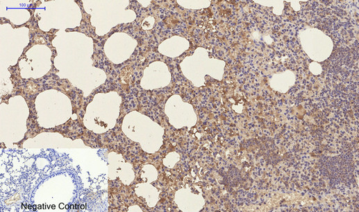 CD23 (3D1) Mouse mAb ABZ4059