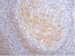 CD23 (3D1) Mouse mAb ABZ4059