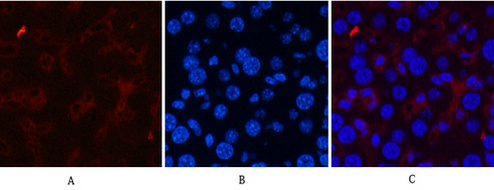 CD21 (3B1) Mouse mAb ABZ4061