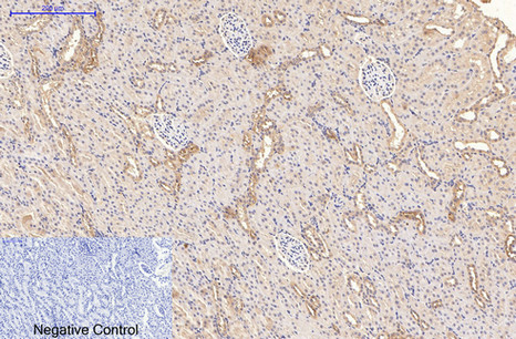 CD21 (3B1) Mouse mAb ABZ4061