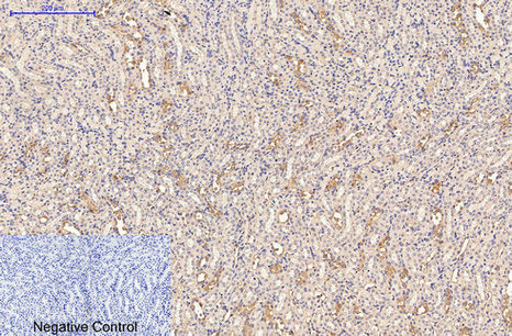 CD21 (3B1) Mouse mAb ABZ4061