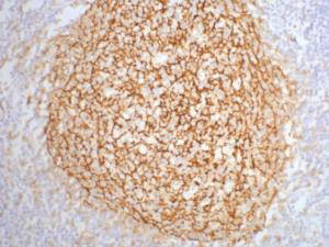 CD21 (3B1) Mouse mAb ABZ4061