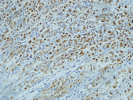 CD15 Mouse mAb ABZ4062