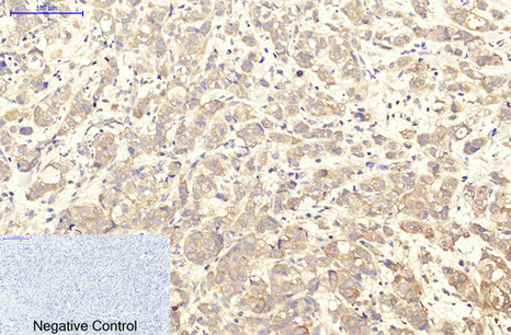 ITGA2B/CD41 (9G4) Mouse mAb ABZ4063