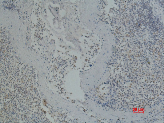 ITGA2B/CD41 (9G4) Mouse mAb ABZ4063