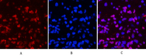 Progesterone Receptor Mouse mAb ABZ4064