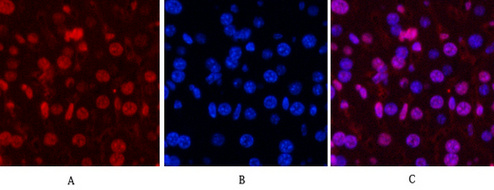 Progesterone Receptor Mouse mAb ABZ4064