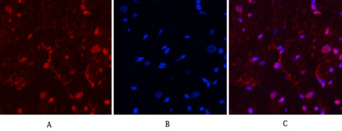Progesterone Receptor Mouse mAb ABZ4064