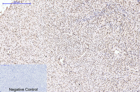 Progesterone Receptor Mouse mAb ABZ4064