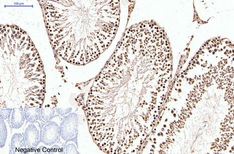 Progesterone Receptor Mouse mAb ABZ4064