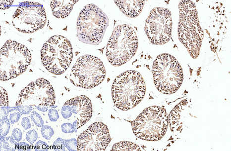 Progesterone Receptor Mouse mAb ABZ4064