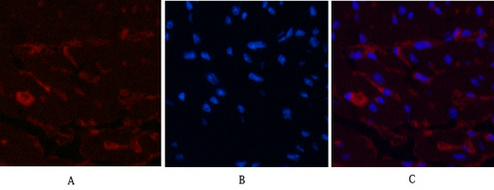 CD1a (4C3) Mouse mAb ABZ4065