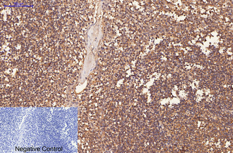 CD1a (4C3) Mouse mAb ABZ4065