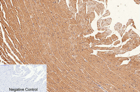 CD1a (4C3) Mouse mAb ABZ4065