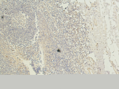 CD1a (4C3) Mouse mAb ABZ4065