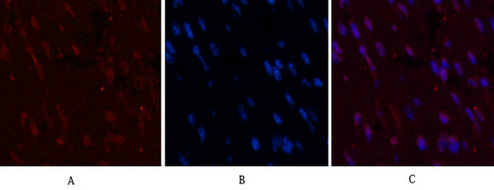 CD5 (10F9) Mouse mAb ABZ4067