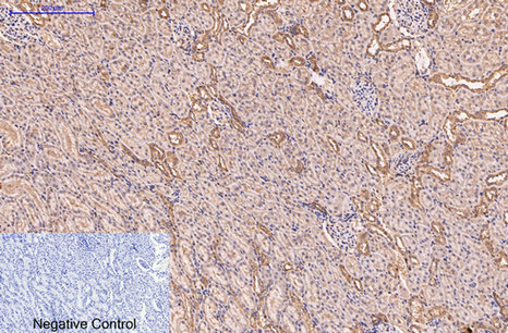 CD5 (10F9) Mouse mAb ABZ4067
