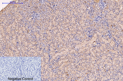 CD5 (10F9) Mouse mAb ABZ4067