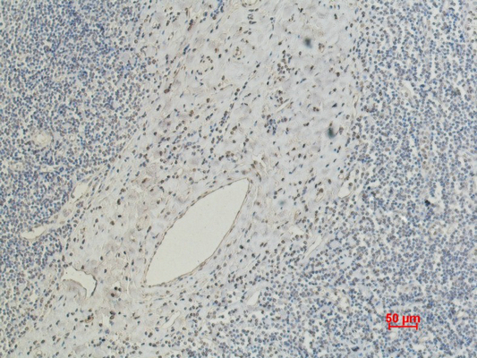CD5 (10F9) Mouse mAb ABZ4067