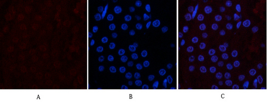CD10 (7C7) Mouse mAb ABZ4068