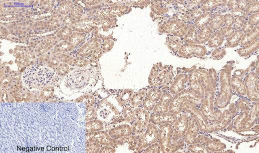 CD10 (7C7) Mouse mAb ABZ4068