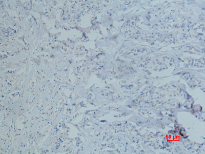CD10 (7C7) Mouse mAb ABZ4068