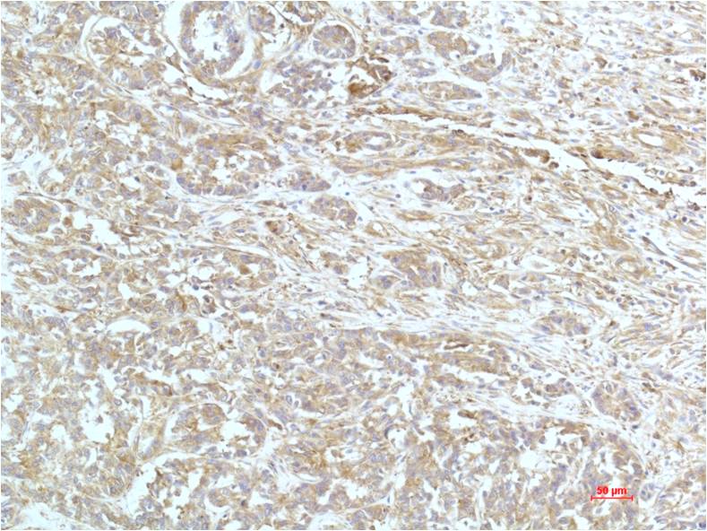 alpha Actinin (1A5) Mouse mAb ABZ4069