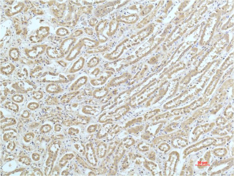 alpha Actinin (1A5) Mouse mAb ABZ4069