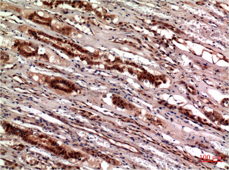 Cystatin C (7E3) Mouse mAb ABZ4073