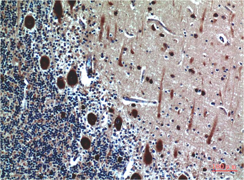 Cystatin C (7E3) Mouse mAb ABZ4073