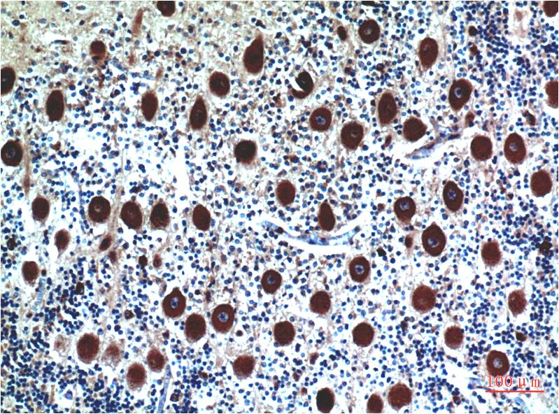 Cystatin C (7E3) Mouse mAb ABZ4073