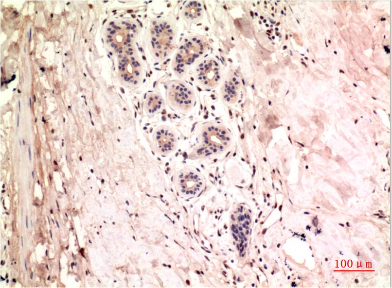 gamma Tubulin (8H4) Mouse mAb ABZ4074