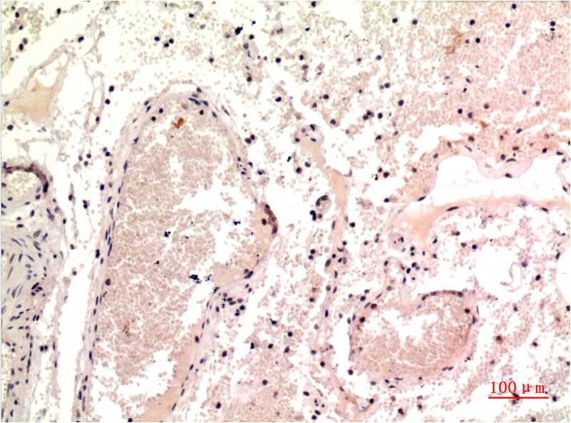 gamma Tubulin (9B5) Mouse mAb ABZ4075