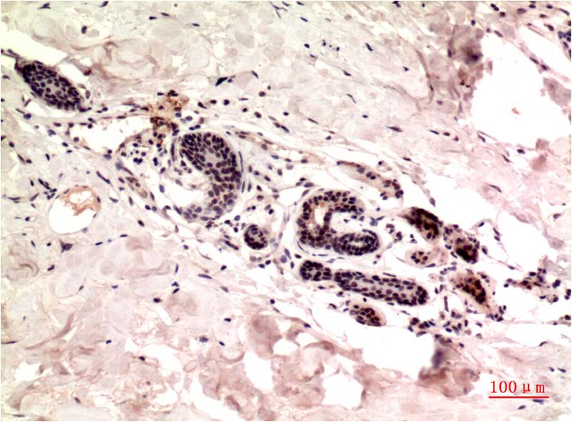 gamma Tubulin (9B5) Mouse mAb ABZ4075