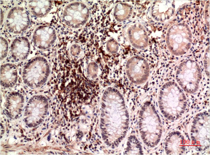 epsilon Tubulin (4C4) Mouse mAb ABZ4076