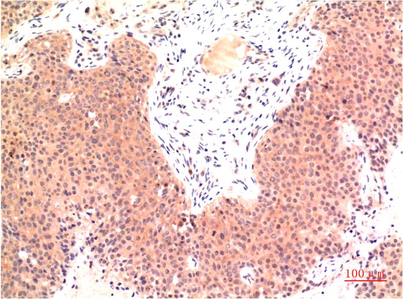 epsilon Tubulin (4C4) Mouse mAb ABZ4076