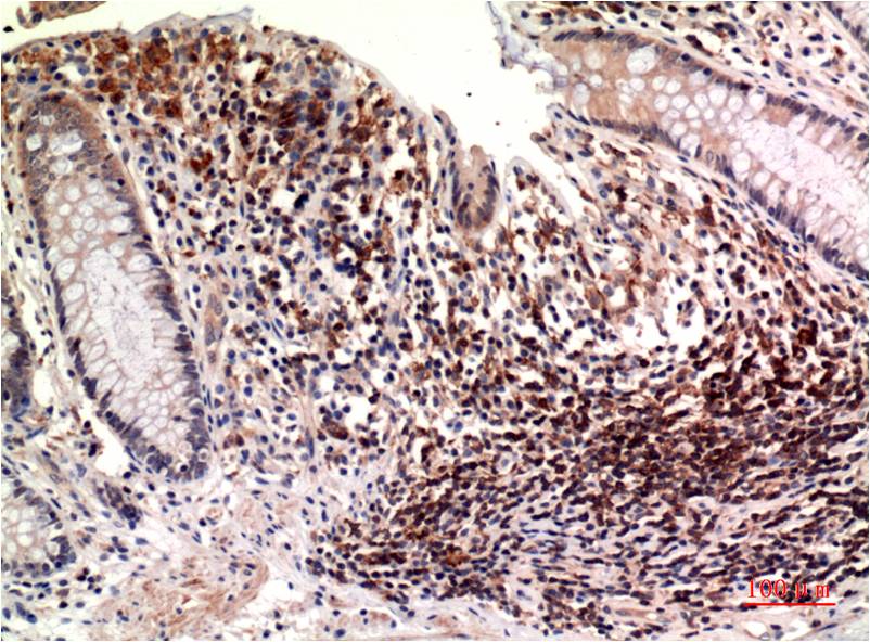 epsilon Tubulin (7D3) Mouse mAb ABZ4078