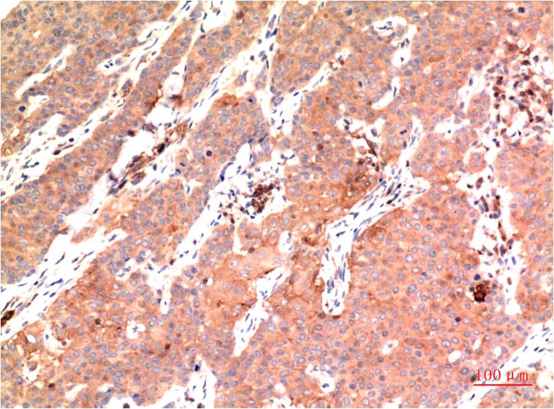 epsilon Tubulin (7D3) Mouse mAb ABZ4078