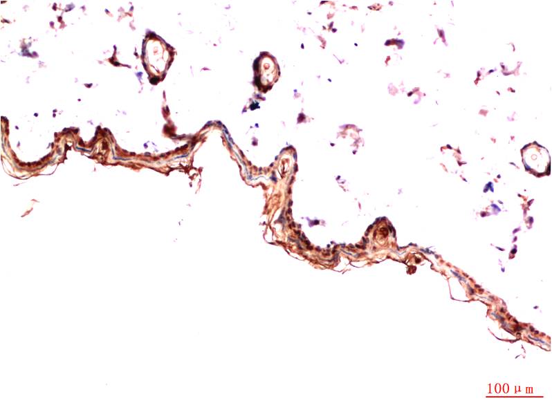 PDGFR alpha (7H6) Mouse mAb ABZ4080