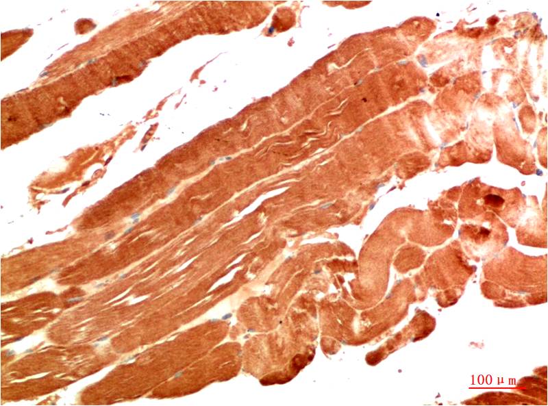NBR1 (7H2) Mouse mAb ABZ4083
