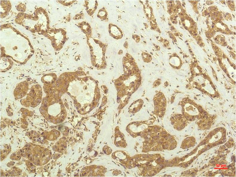 S6K1 (3A2) Mouse mAb ABZ4085
