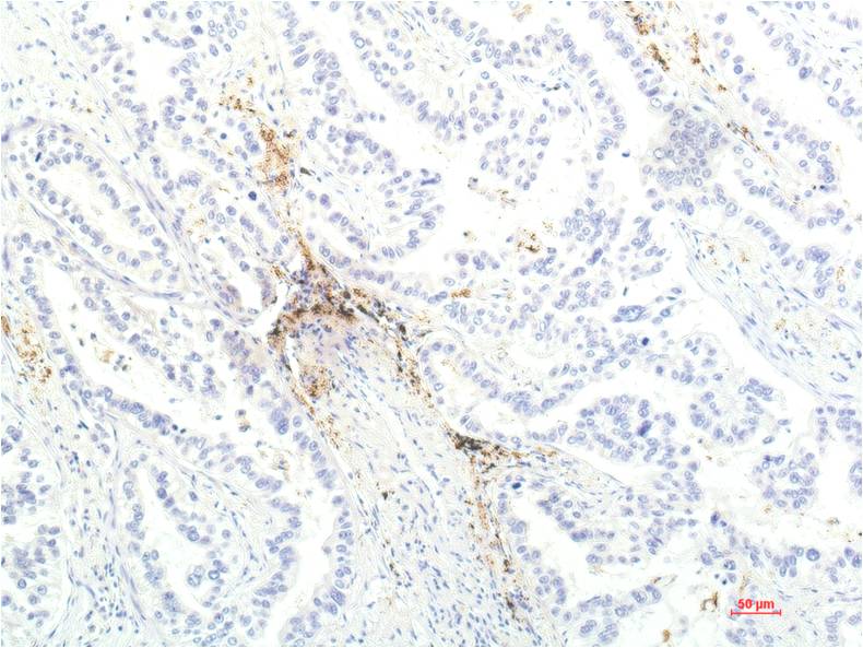 JAK1 (8D8) Mouse mAb ABZ4086