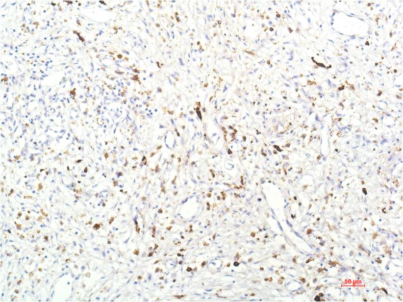JAK1 (8D8) Mouse mAb ABZ4086
