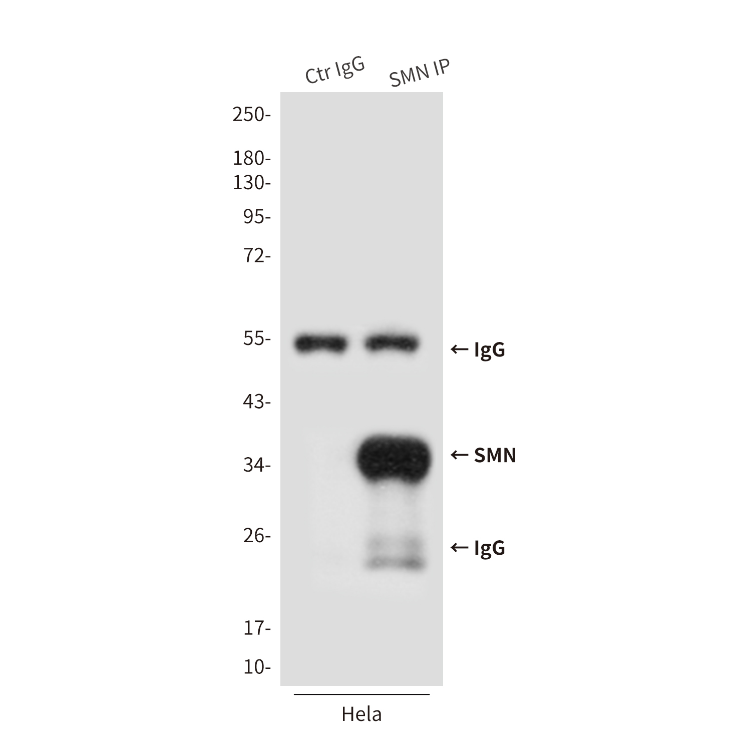 SMN/Gemin 1 (2F1) Mouse mAb ABZ4089