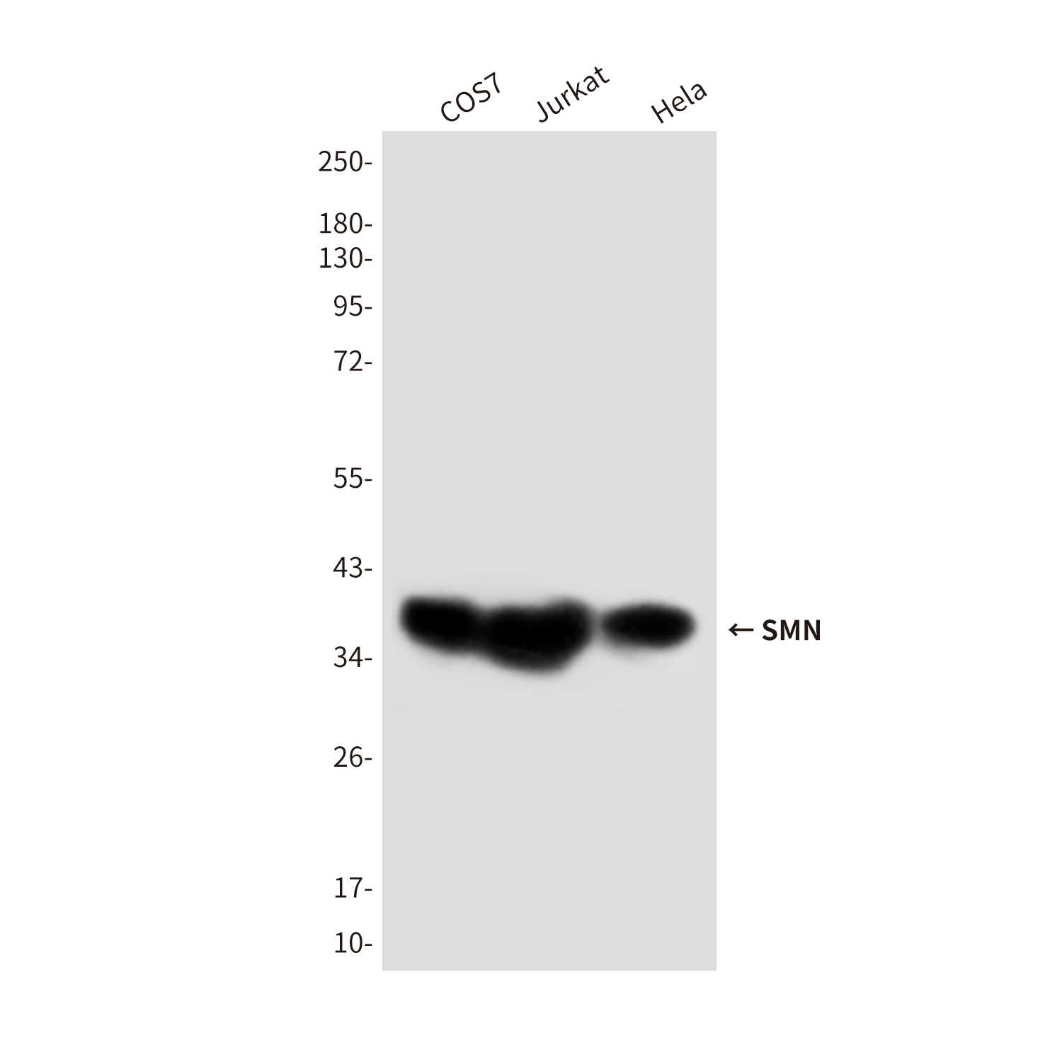 SMN/Gemin 1 (2F1) Mouse mAb ABZ4089