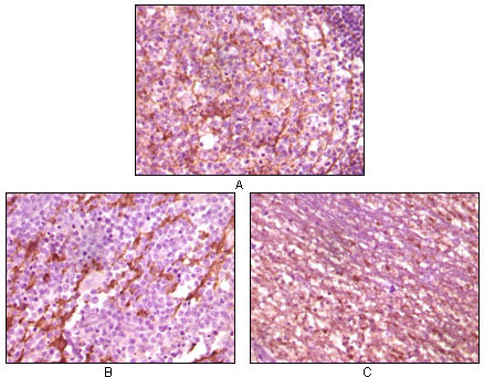 Dynamin 1 (5B9) Mouse mAb ABZ4091