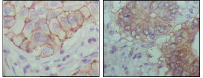 Ephrin Receptor B1 (9B4) Mouse mAb ABZ4092